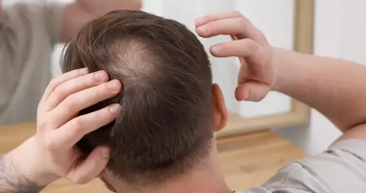 crown hair transplant