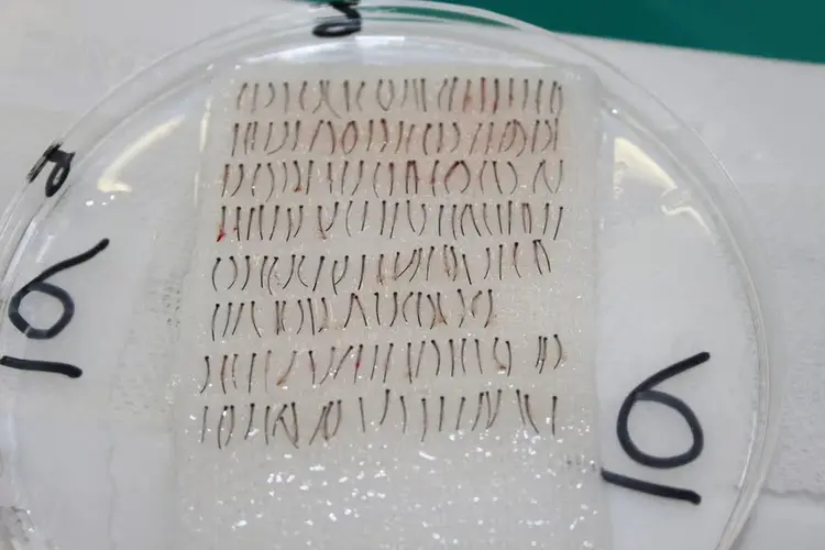 الطعم المستخدم لزراعة الشعر في الرأس من شعر اللحية

