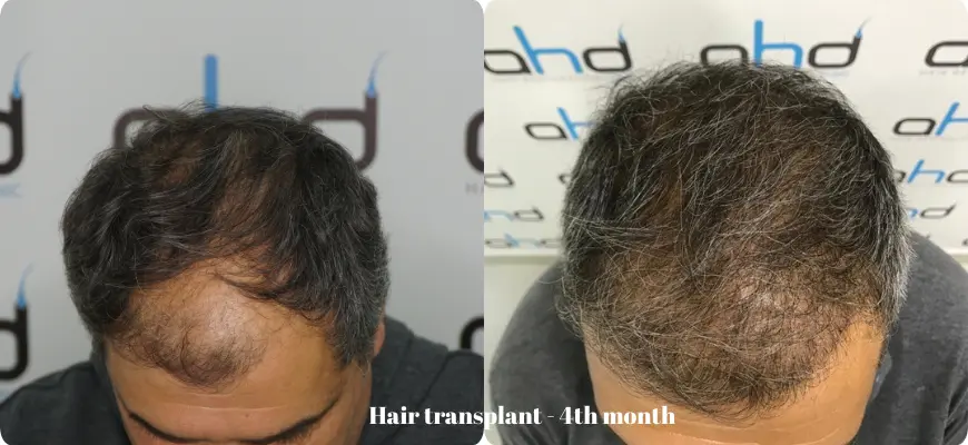 4 months