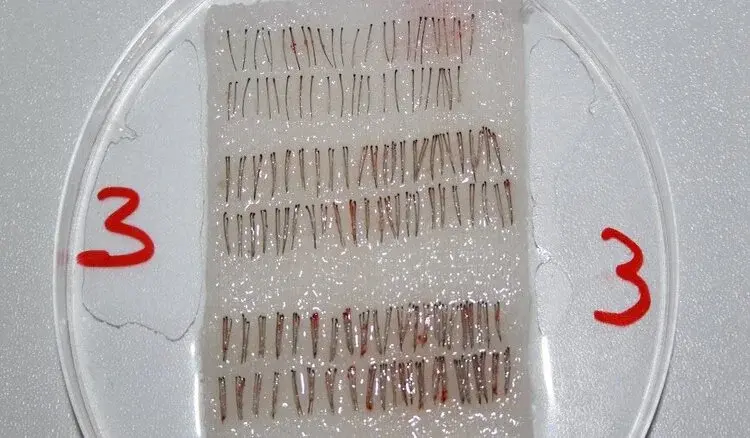 графт волос